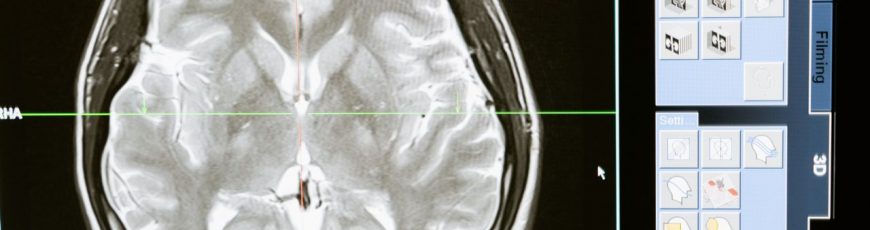 Una nueva tecnología israelí detecta indicios del alzhéimer antes del comienzo de síntomas