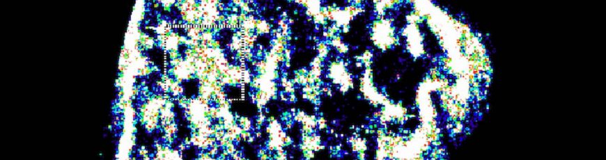 Sondas fluorescentes permiten obtener imágenes del ADN con una resolución insólita