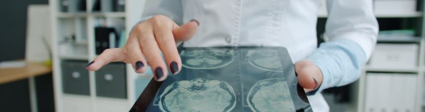 La pubertad y el embarazo tienen una disminución de materia gris, pero la menopausia no