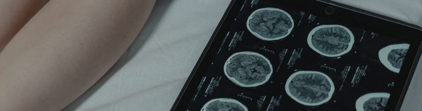 Una neuroprótesis para la parálisis permite a los pacientes comunicar palabras y gestos