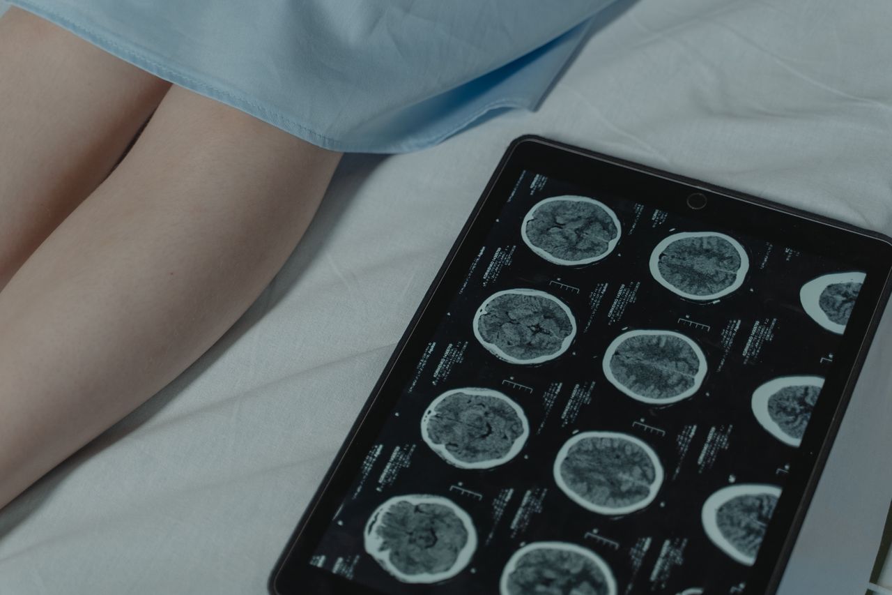 Una neuroprótesis para la parálisis permite a los pacientes comunicar palabras y gestos