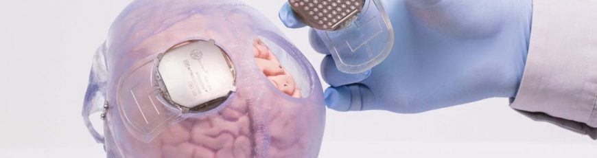 Conectar el cerebro con el celular: tecnología posible en diez años