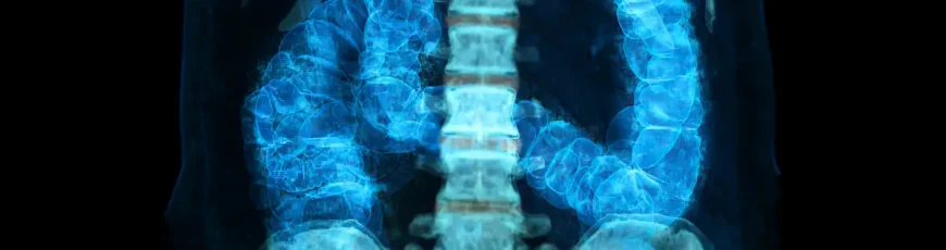 Cáncer precoz: ¿por qué aumentan los casos en menores de 50 años?