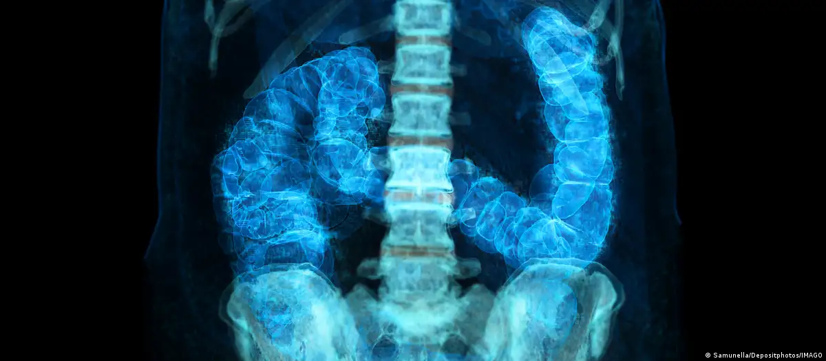 Cáncer precoz: ¿por qué aumentan los casos en menores de 50 años?