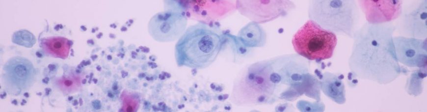 Desarrollan un sistema de IA para detectar una de las infecciones sexuales más frecuentes del mundo
