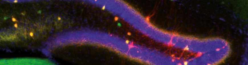 Hallan cómo el cerebro encuentra un equilibrio entre actualizar la memoria con nuevos datos y conservar los recuerdos