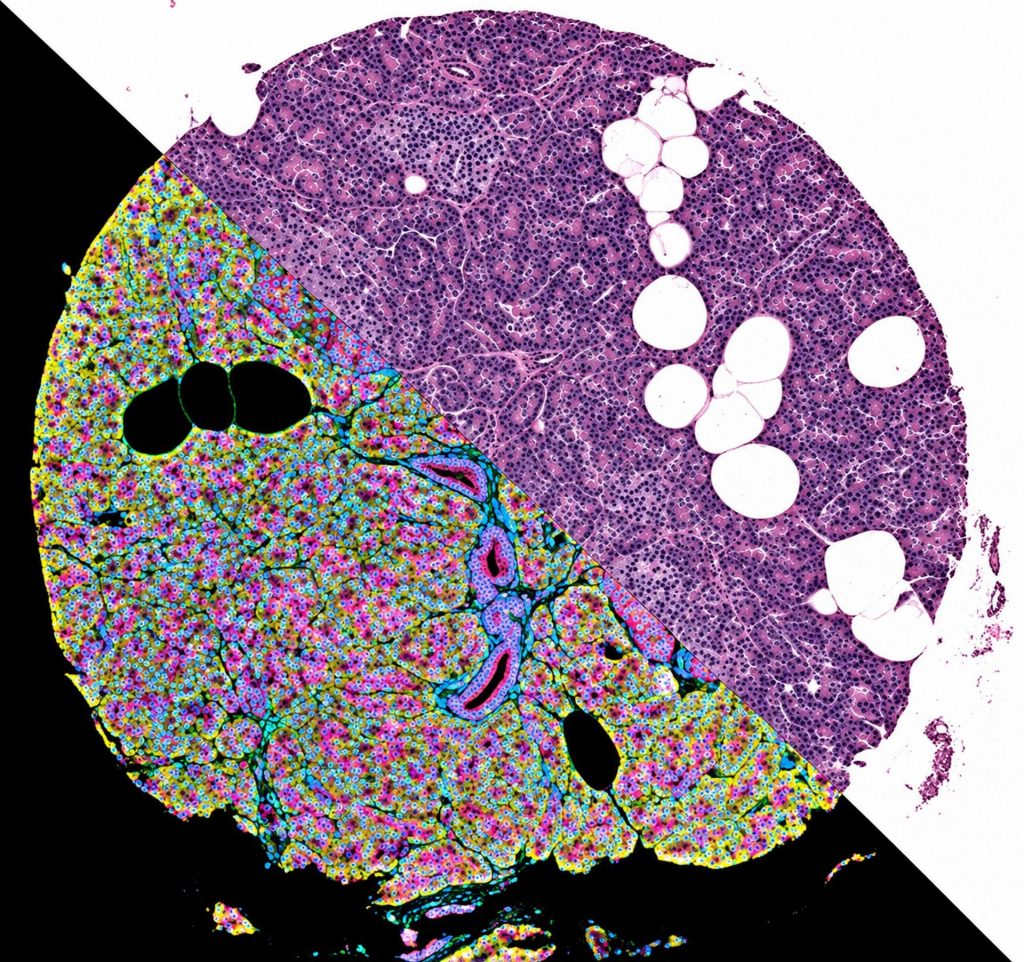 Un atlas celular del páncreas con resolución espacial. Imagen facilitada por el CNAG.