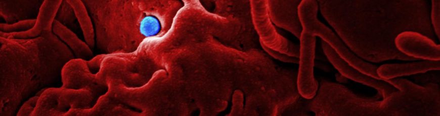 Nigeria confirma su primer caso de ébola